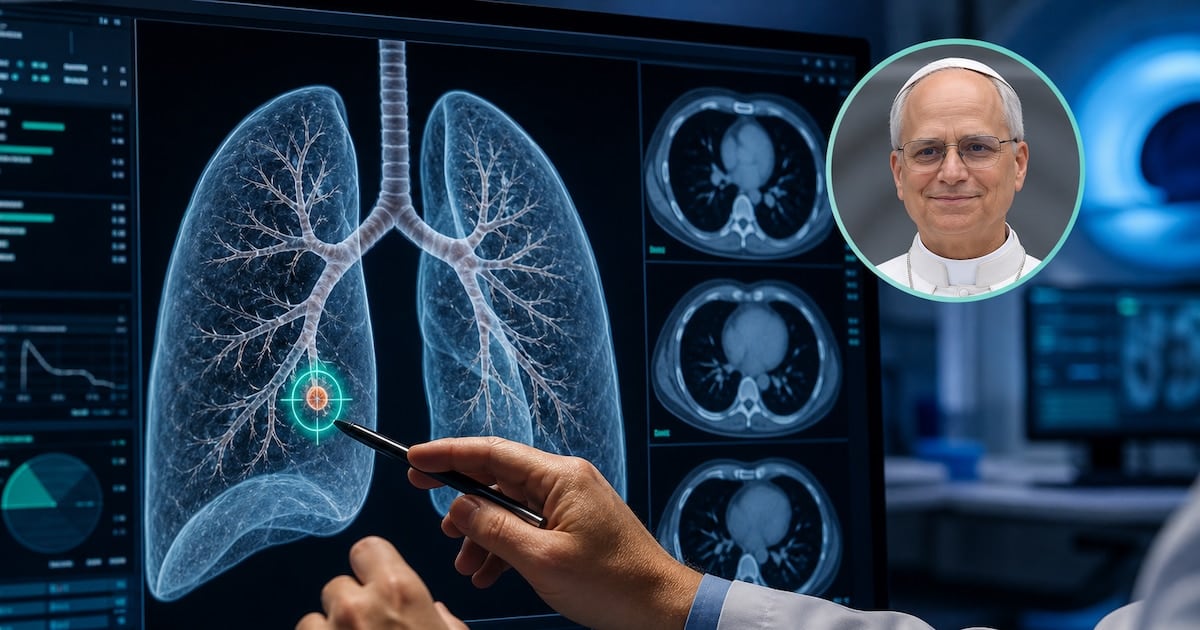 Un hallazgo de tres milímetros: qué hay detrás de la decisión de operar un nódulo pulmonar